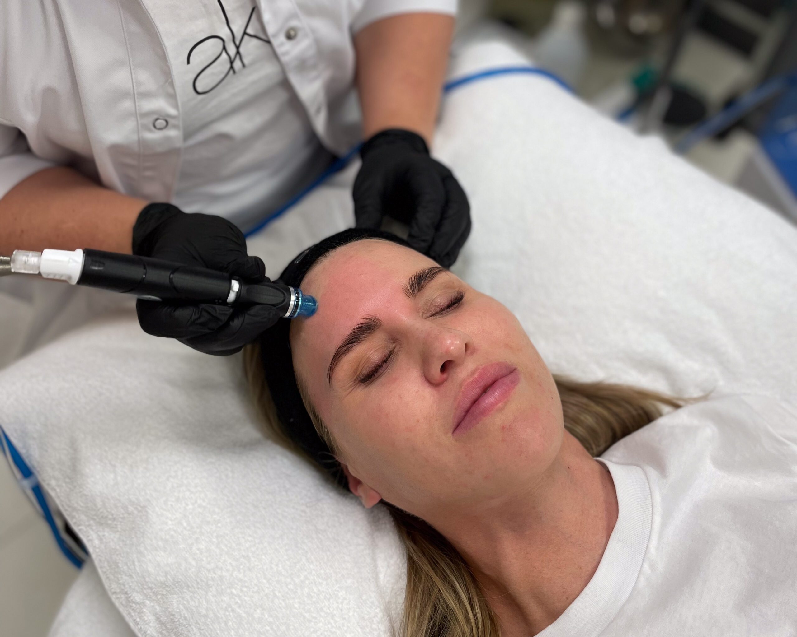 hydrafacial ansiktsbehandling akademikliniken